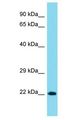NCKAP5 Antibody - NCKAP5 antibody Western Blot of MCF7. Antibody dilution: 1 ug/ml.  This image was taken for the unconjugated form of this product. Other forms have not been tested.