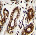 NCL / Nucleolin Antibody - NCL Antibody (Center E443) immunohistochemistry of formalin-fixed and paraffin-embedded human breast tissue followed by peroxidase-conjugated secondary antibody and DAB staining.