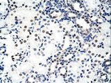 NCL / Nucleolin Antibody - NCL / Nucleolin antibody ARP40584_T100-NP_005372-NCL (nucleolin) Antibody was used in IHC to stain formalin-fixed, paraffin-embedded human kidney.  This image was taken for the unconjugated form of this product. Other forms have not been tested.