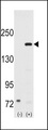 NCOA1 / SRC-1 Antibody - Western blot of SRC1 (arrow) using rabbit polyclonal SRC1 Antibody. 293 cell lysates (2 ug/lane) either nontransfected (Lane 1) or transiently transfected with the SRC1 gene (Lane 2) (Origene Technologies).