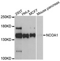 NCOA1 / SRC-1 Antibody - Western blot analysis of extracts of various cell lines, using NCOA1 antibody at 1:1000 dilution. The secondary antibody used was an HRP Goat Anti-Rabbit IgG (H+L) at 1:10000 dilution. Lysates were loaded 25ug per lane and 3% nonfat dry milk in TBST was used for blocking. An ECL Kit was used for detection and the exposure time was 90s.