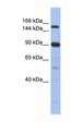 NCOA2 / TIF2 Antibody - NCOA2 antibody Western blot of Fetal Thymus lysate. This image was taken for the unconjugated form of this product. Other forms have not been tested.