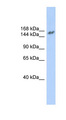 NCOA3 / SRC-3 / AIB1 Antibody - NCOA3 antibody Western blot of Fetal Brain lysate. This image was taken for the unconjugated form of this product. Other forms have not been tested.
