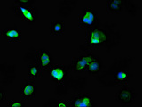 NCOA5 Antibody - Immunofluorescent analysis of MCF-7 cells using NCOA5 Antibody at dilution of 1:100 and Alexa Fluor 488-congugated AffiniPure Goat Anti-Rabbit IgG(H+L)