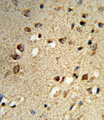 NCOA7 Antibody - Formalin-fixed and paraffin-embedded human brain tissue reacted with NCOA7 Antibody , which was peroxidase-conjugated to the secondary antibody, followed by DAB staining. This data demonstrates the use of this antibody for immunohistochemistry; clinical relevance has not been evaluated.