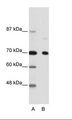 NCOR2 / SMRT Antibody - A: Marker, B: Hela Cell Lysate.  This image was taken for the unconjugated form of this product. Other forms have not been tested.