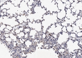 NCR1 / NKP46 Antibody - IHC analysis of NCR1 using anti-NCR1 antibody. NCR1 was detected in paraffin-embedded section of mouse lung tissues. Heat mediated antigen retrieval was performed in citrate buffer (pH6, epitope retrieval solution) for 20 mins. The tissue section was blocked with 10% goat serum. The tissue section was then incubated with 1µg/ml rabbit anti-NCR1 Antibody overnight at 4°C. Biotinylated goat anti-rabbit IgG was used as secondary antibody and incubated for 30 minutes at 37°C. The tissue section was developed using Strepavidin-Biotin-Complex (SABC) with DAB as the chromogen.