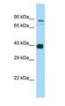 NDOR1 Antibody - NDOR1 antibody Western Blot of ACHN.  This image was taken for the unconjugated form of this product. Other forms have not been tested.