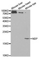 NDP Antibody - Western blot analysis of extracts of various cell lines.