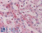 NDRG2 Antibody - Anti-NDRG2 antibody IHC of human liver. Immunohistochemistry of formalin-fixed, paraffin-embedded tissue after heat-induced antigen retrieval. Antibody concentration 5 ug/ml.  This image was taken for the unconjugated form of this product. Other forms have not been tested.