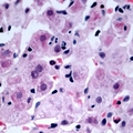 NDRG4 Antibody - Immunohistochemical analysis of NDRG4 staining in human liver formalin fixed paraffin embedded tissue section. The section was pre-treated using heat mediated antigen retrieval with sodium citrate buffer (pH 6.0). The section was then incubated with the antibody at room temperature and detected with HRP and AEC as chromogen. The section was then counterstained with hematoxylin and mounted with DPX.
