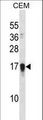 NDSP / FAM163A Antibody - FAM163A Antibody western blot of CEM cell line lysates (35 ug/lane). The FAM163A antibody detected the FAM163A protein (arrow).