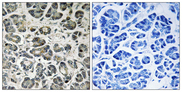 NDUFA8 Antibody - Immunohistochemistry analysis of paraffin-embedded human pancreas tissue, using NDUFA8 Antibody. The picture on the right is blocked with the synthesized peptide.