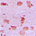 NDUFA8 Antibody - Immunohistochemical analysis of NDUFA8 staining in human brain formalin fixed paraffin embedded tissue section. The section was pre-treated using heat mediated antigen retrieval with sodium citrate buffer (pH 6.0). The section was then incubated with the antibody at room temperature and detected using an HRP conjugated compact polymer system. DAB was used as the chromogen. The section was then counterstained with hematoxylin and mounted with DPX.