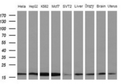 NDUFB11 Antibody - Western blot of extracts (10ug) from 5 different cell lines and 4 human tissue by using anti-NDUFB11 monoclonal antibody (1: HeLa; 2: HepG2; 3: K562; 4: Mcf7; 5: SVT2; 6: Liver; 7: Testis; 8: Brain; 9: Uterus) at 1:200 dilution.