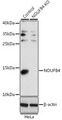 NDUFB4 / B15 Antibody - Western blot analysis of extracts from normal (control) and NDUFB4 knockout (KO) HeLa cells, using NDUFB4 antibody at 1:1000 dilution. The secondary antibody used was an HRP Goat Anti-Rabbit IgG (H+L) at 1:10000 dilution. Lysates were loaded 25ug per lane and 3% nonfat dry milk in TBST was used for blocking. An ECL Kit was used for detection and the exposure time was 30s.