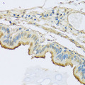 NDUFB5 Antibody - Immunohistochemistry of paraffin-embedded human trachea using NDUFB5 antibody at dilution of 1:100 (40x lens).