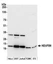 NDUFB6 Antibody - Detection of human and mouse NDUFB6 by western blot. Samples: Whole cell lysate (15 µg) from HeLa, HEK293T, Jurkat, mouse TCMK-1, and mouse NIH 3T3 cells prepared using NETN lysis buffer. Antibody: Affinity purified rabbit anti-NDUFB6 antibody used for WB at 0.04 µg/ml. Detection: Chemiluminescence with an exposure time of 30 seconds.