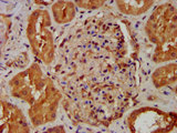 NDUFB8 Antibody - Immunohistochemistry image at a dilution of 1:400 and staining in paraffin-embedded human kidney tissue performed on a Leica BondTM system. After dewaxing and hydration, antigen retrieval was mediated by high pressure in a citrate buffer (pH 6.0) . Section was blocked with 10% normal goat serum 30min at RT. Then primary antibody (1% BSA) was incubated at 4 °C overnight. The primary is detected by a biotinylated secondary antibody and visualized using an HRP conjugated SP system.