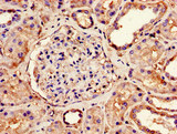 NDUFS4 Antibody - Immunohistochemistry image of paraffin-embedded human kidney tissue at a dilution of 1:100