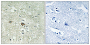 NDUFV3 Antibody - Immunohistochemistry analysis of paraffin-embedded human brain, using NDUFV3 Antibody. The picture on the right is blocked with the synthesized peptide.