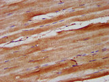 NEB / Nebulin Antibody - Immunohistochemistry image at a dilution of 1:600 and staining in paraffin-embedded human skeletal muscle tissue performed on a Leica BondTM system. After dewaxing and hydration, antigen retrieval was mediated by high pressure in a citrate buffer (pH 6.0) . Section was blocked with 10% normal goat serum 30min at RT. Then primary antibody (1% BSA) was incubated at 4 °C overnight. The primary is detected by a biotinylated secondary antibody and visualized using an HRP conjugated SP system.