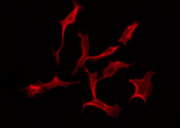 NECL-1 / CADM3 Antibody - Staining NIH-3T3 cells by IF/ICC. The samples were fixed with PFA and permeabilized in 0.1% Triton X-100, then blocked in 10% serum for 45 min at 25°C. The primary antibody was diluted at 1:200 and incubated with the sample for 1 hour at 37°C. An Alexa Fluor 594 conjugated goat anti-rabbit IgG (H+L) Ab, diluted at 1/600, was used as the secondary antibody.