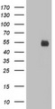 Nectin-1 / PVRL1 Antibody - HEK293T cells were transfected with the pCMV6-ENTRY control (Left lane) or pCMV6-ENTRY PVRL1 (Right lane) cDNA for 48 hrs and lysed. Equivalent amounts of cell lysates (5 ug per lane) were separated by SDS-PAGE and immunoblotted with anti-PVRL1.