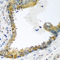 NEDD4L / NEDD4-2 Antibody