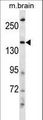 NEDL2 / HECW2 Antibody - HECW2 Antibody western blot of mouse brain tissue lysates (35 ug/lane). The HECW2 antibody detected the HECW2 protein (arrow).