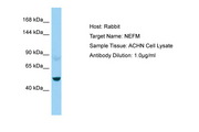 NEFM / NF-M Antibody -  This image was taken for the unconjugated form of this product. Other forms have not been tested.