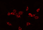 NEGR1 / Neurotractin Antibody - Staining COLO205 cells by IF/ICC. The samples were fixed with PFA and permeabilized in 0.1% Triton X-100, then blocked in 10% serum for 45 min at 25°C. The primary antibody was diluted at 1:200 and incubated with the sample for 1 hour at 37°C. An Alexa Fluor 594 conjugated goat anti-rabbit IgG (H+L) Ab, diluted at 1/600, was used as the secondary antibody.