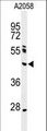 NEIL1 Antibody - Western blot of NEIL1 Antibody in A2058 cell line lysates (35 ug/lane). NEIL1 (arrow) was detected using the purified antibody.