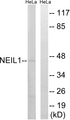 NEIL1 Antibody - Western blot analysis of lysates from HeLa cells, using NEIL1 Antibody. The lane on the right is blocked with the synthesized peptide.