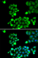 NEIL1 Antibody - Immunofluorescence analysis of HeLa cells.