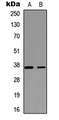 NEIL2 Antibody - Western blot analysis of NEIL2 expression in HEK293T (A); PC12 (B) whole cell lysates.