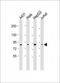 NEK10 Antibody - All lanes: Anti-NEK10 Antibody (Center) at 1:2000 dilution. Lane 1: A431 whole cell lysates. Lane 2: HeLa whole cell lysates. Lane 3: HepG2 whole cell lysates. Lane 4: Jurkat whole cell lysates Lysates/proteins at 20 ug per lane. Secondary Goat Anti-Rabbit IgG, (H+L), Peroxidase conjugated at 1:10000 dilution. Predicted band size: 133 kDa. Blocking/Dilution buffer: 5% NFDM/TBST.
