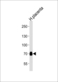 NEK11 Antibody - Western blot of lysate from human placenta tissue lysate, using NEK11L Antibody. Antibody was diluted at 1:1000 at each lane. A goat anti-rabbit IgG H&L (HRP) at 1:5000 dilution was used as the secondary antibody. Lysate at 35ug per lane.