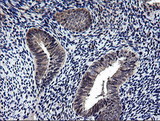 NEK11 Antibody - IHC of paraffin-embedded Human endometrium tissue using anti-NEK11 mouse monoclonal antibody.