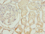 NEK3 Antibody - Immunohistochemistry of paraffin-embedded human kidney tissue at dilution 1:100