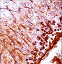 NEK5 Antibody - Mouse Nek5 Antibody immunohistochemistry of formalin-fixed and paraffin-embedded mouse stomach tissue followed by peroxidase-conjugated secondary antibody and DAB staining.
