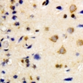 NEK7 Antibody - Immunohistochemical analysis of NEK7 staining in human brain formalin fixed paraffin embedded tissue section. The section was pre-treated using heat mediated antigen retrieval with sodium citrate buffer (pH 6.0). The section was then incubated with the antibody at room temperature and detected using an HRP polymer system. DAB was used as the chromogen. The section was then counterstained with hematoxylin and mounted with DPX.