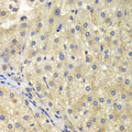 NEK8 Antibody - Immunohistochemistry of paraffin-embedded human liver injury tissue.