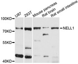 NELL1 Antibody - Western blot analysis of extracts of various cell lines, using NELL1 antibody at 1:1000 dilution. The secondary antibody used was an HRP Goat Anti-Rabbit IgG (H+L) at 1:10000 dilution. Lysates were loaded 25ug per lane and 3% nonfat dry milk in TBST was used for blocking. An ECL Kit was used for detection and the exposure time was 10s.