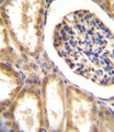 NEP / DDR1 Antibody - DDR1 Antibody immunohistochemistry of formalin-fixed and paraffin-embedded human kidney tissue followed by peroxidase-conjugated secondary antibody and DAB staining.