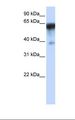 NEPH1 / KIRREL Antibody - HepG2 cell lysate. Antibody concentration: 1.0 ug/ml. Gel concentration: 12%.  This image was taken for the unconjugated form of this product. Other forms have not been tested.