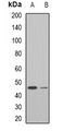 NEU1 / NEU Antibody - Western blot analysis of Neu1 expression in mouse liver (A); rat liver (B) whole cell lysates.