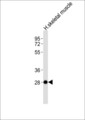 NEURL2 Antibody - Anti-NEURL2 Antibody at 1:1000 dilution + human skeletal muscle lysates Lysates/proteins at 20 ug per lane. Secondary Goat Anti-Rabbit IgG, (H+L),Peroxidase conjugated at 1/10000 dilution Predicted band size : 32 kDa Blocking/Dilution buffer: 5% NFDM/TBST.