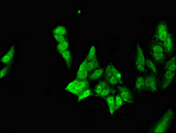 NEUROD1 Antibody - Immunofluorescent analysis of Hela cells diluted at 1:100 and Alexa Fluor 488-congugated AffiniPure Goat Anti-Rabbit IgG(H+L)