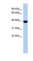 NEUROD4 Antibody - NEUROD4 antibody Western blot of Fetal Spleen lysate. This image was taken for the unconjugated form of this product. Other forms have not been tested.